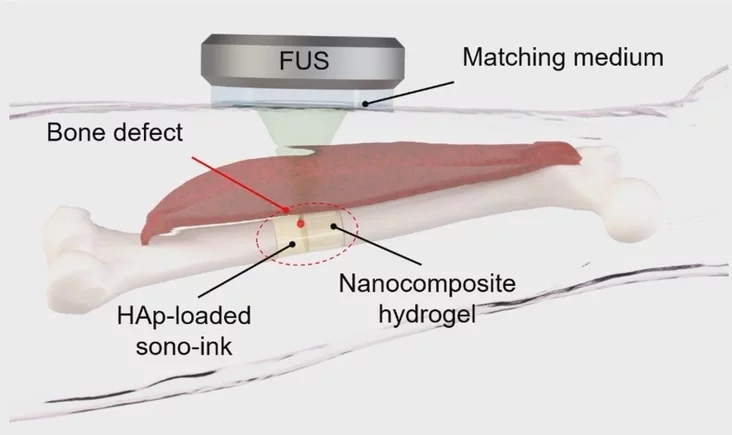 akustyčny abjomny druk hłybokaha praniknieńniadeep-penetration acoustic volumetric printing ultrazvukovaja objemnaja piečať hłubokoho proniknovienija