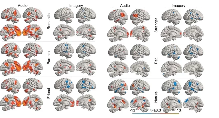 Different types of love activate different parts of the brain Raznyje vidy lubvi aktivirujut raznyje časti mozha Roznyja typy lubovi aktyvizujuć roznyja častki mozhu